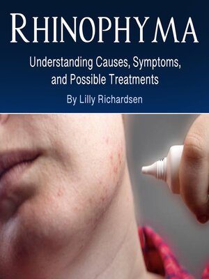 cover image of Rhinophyma